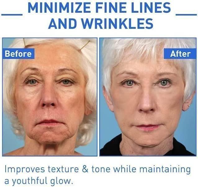 Botox Anti-Aging Serum (Pack Of 2)