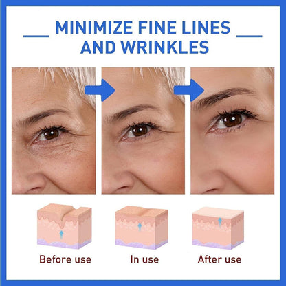 Botox Anti-Aging Serum (Pack Of 2)